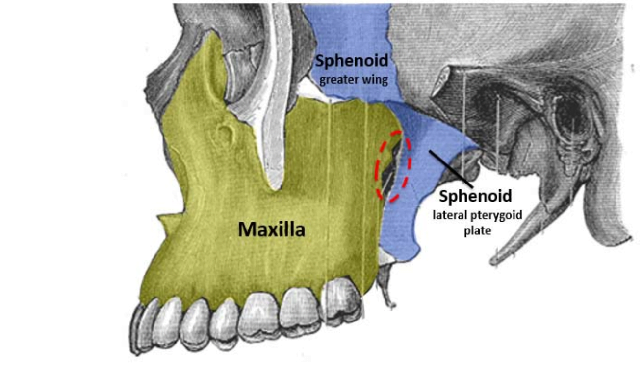 حفره پتریگوپالاتین  آناتومی فک و دهان و دندان
